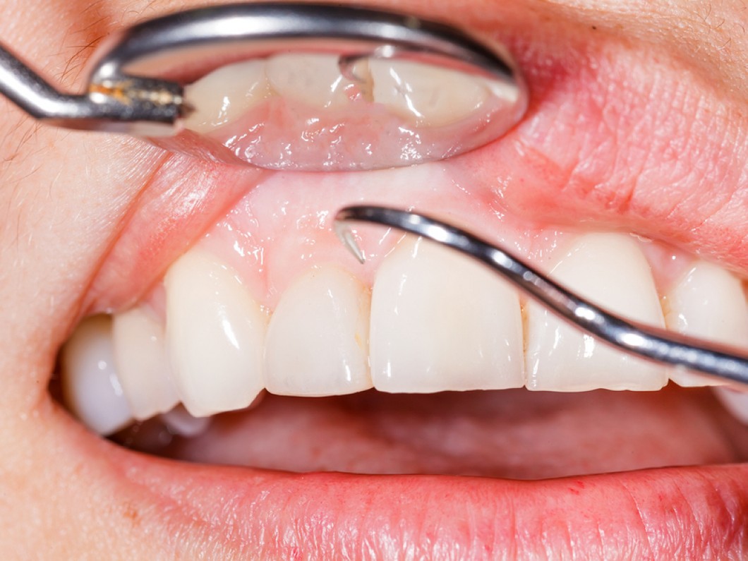 https://www.dentistasecija.es/wp-content/uploads/2017/03/dentistas-encias-ecija.jpg