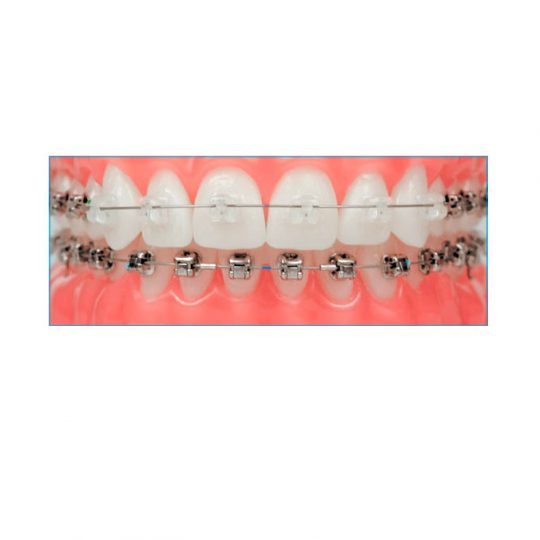 https://www.dentistasecija.es/wp-content/uploads/2017/03/ortodoncia1-540x540.jpg